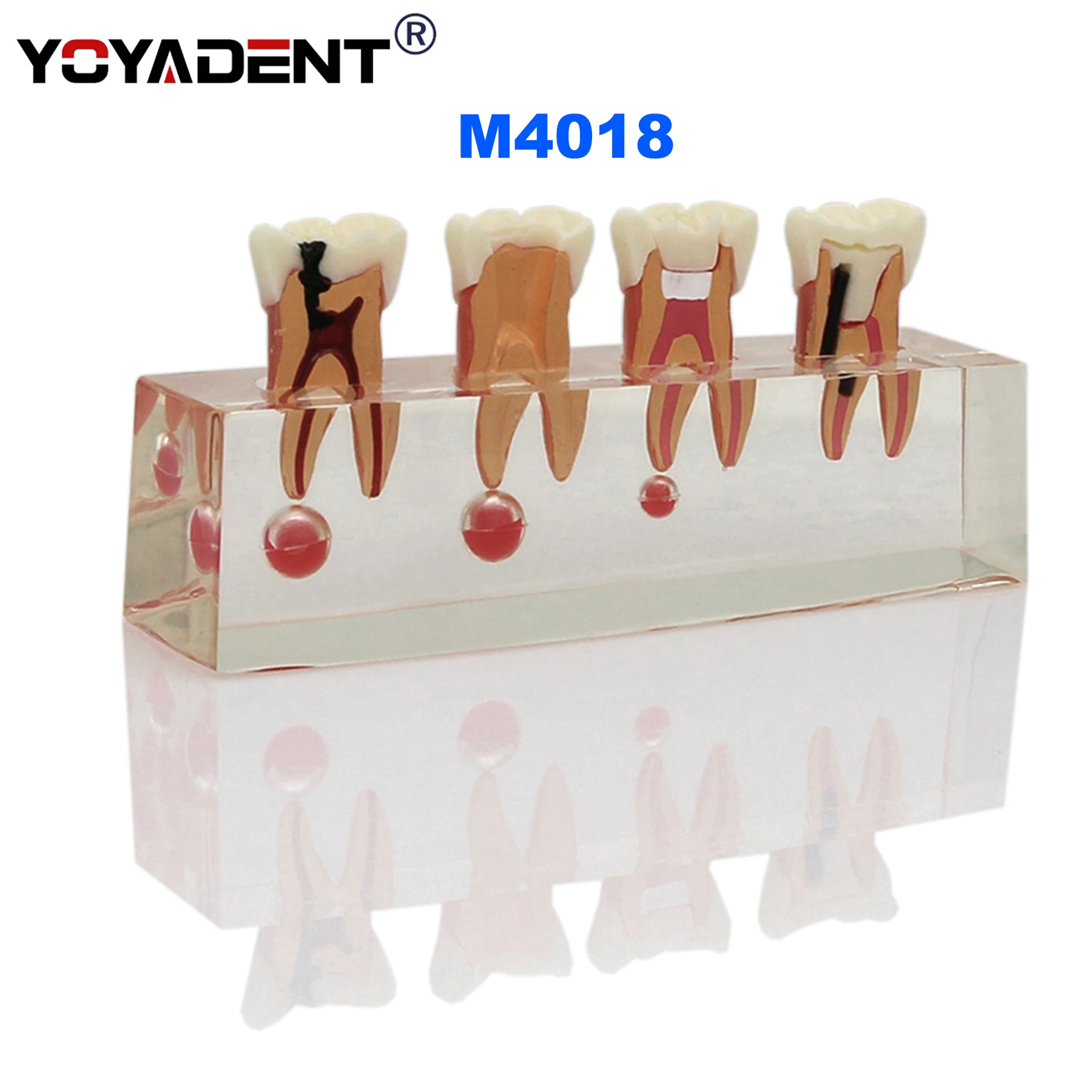 

Dental Teeth Model 4-stage molar rootcanal treatment Model Dentists Teaching Demo Model