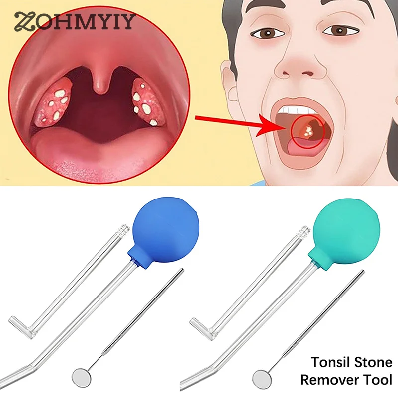 

3 шт./набор, инструменты для удаления миндалин