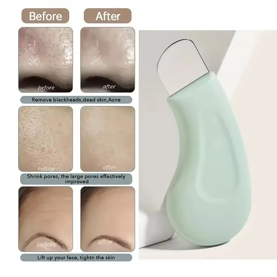 Ergonomic Blackhead & Whitehead Remover Stainless Steel Pore Cleanser for Nose Face Gentle Exfoliating Skin Care Tool