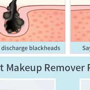 Stock américain EMS Micro dispositif de levage de courant Vibration LED visage rajeunissement de la peau dissolvant de rides Anti-âge dispositif de beauté du visage