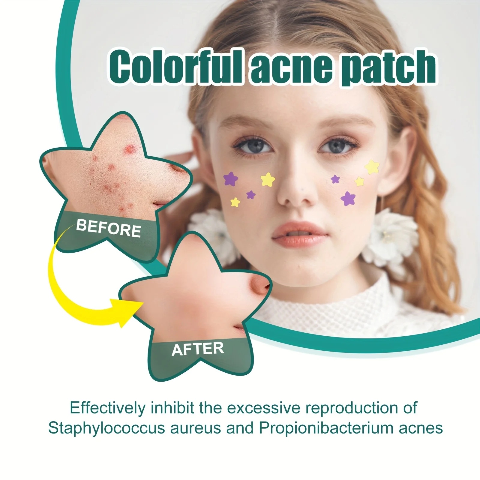 112 Pieces Acne Patch Beauty Tool Star Shape Acne Concealer Facial Spot Repair Dimples Acne Spot Stickers