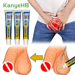 3Pcs Varicocele Cream Genital Scrotum Varicose Vein Remover Herbal Ointment Angiitis Phlebitis Veins Pain Swell Treatment A1730