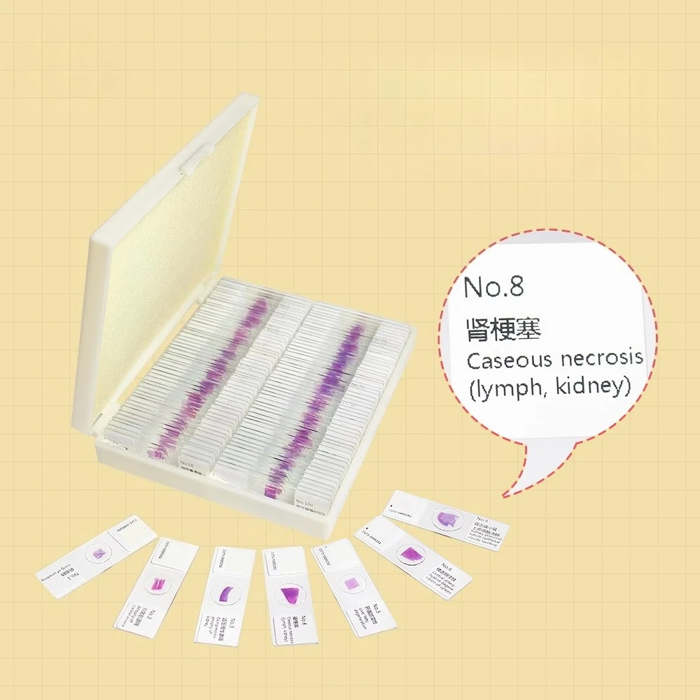 100PCS Human Medical Pathology Tissue Slice Set HE Stained Microscope Slides for Medical and University Education