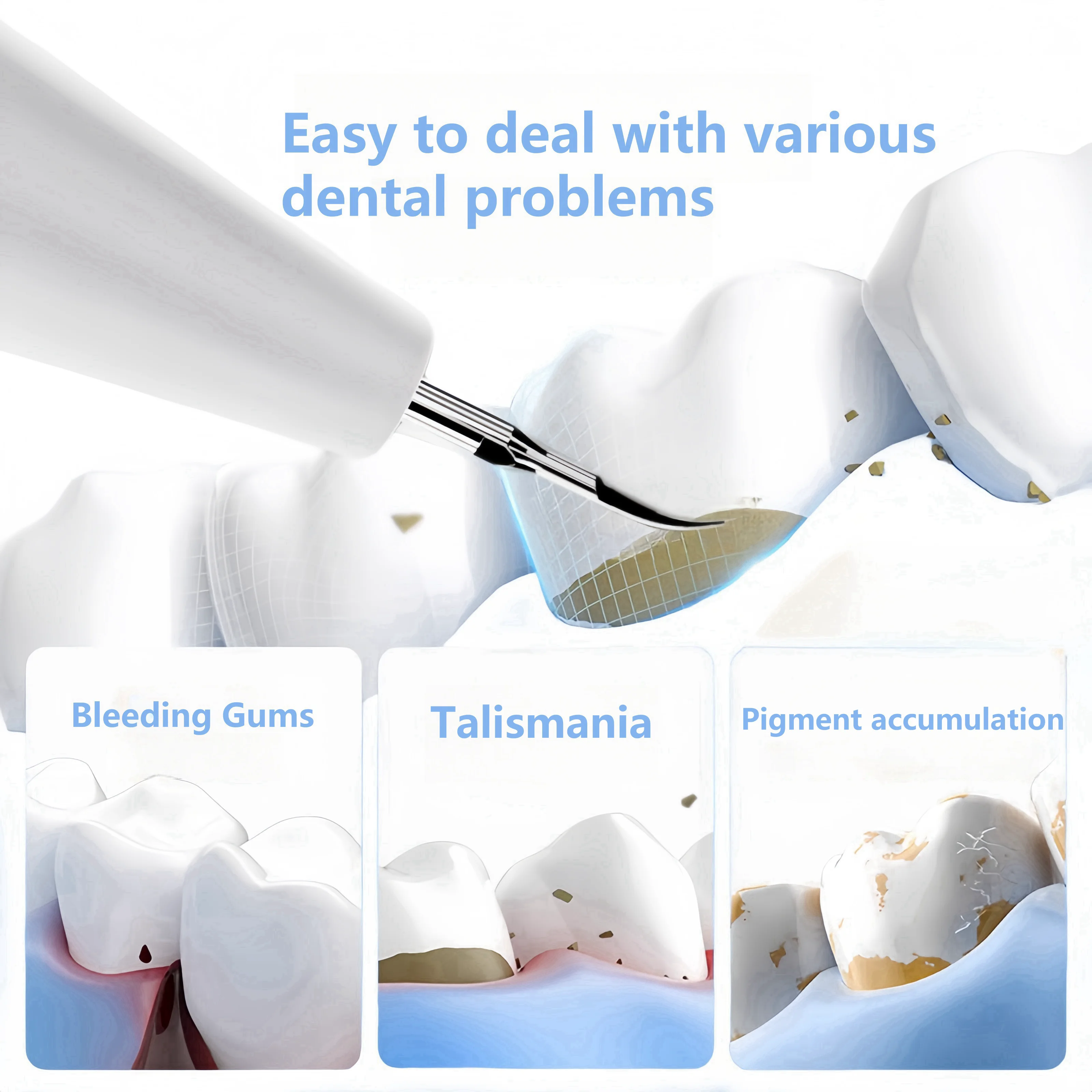 مبيضة أسنان بالموجات فوق الصوتية لإزالة الجير الأسنان الكهربائية منظف الأسنان حساب التفاضل والتكامل مزيل البلاك إزالة حجر الأسنان #2