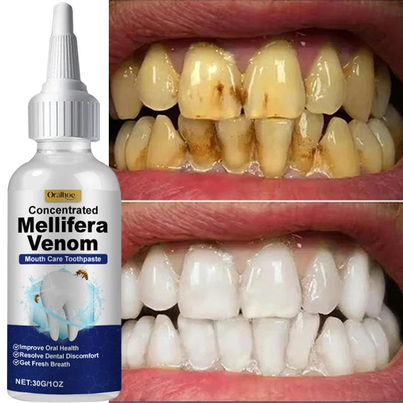 Pulizia dei denti Siero sbiancante Rimuovi placca Denti bianchi Gel Denti Macchie di fumo giallo Dentifricio Alito fresco Cura dell'igiene orale