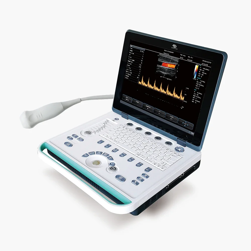 Medical Digital Diagnostic Ultrasound Machine E80 Doppler Ultrasound Scanner