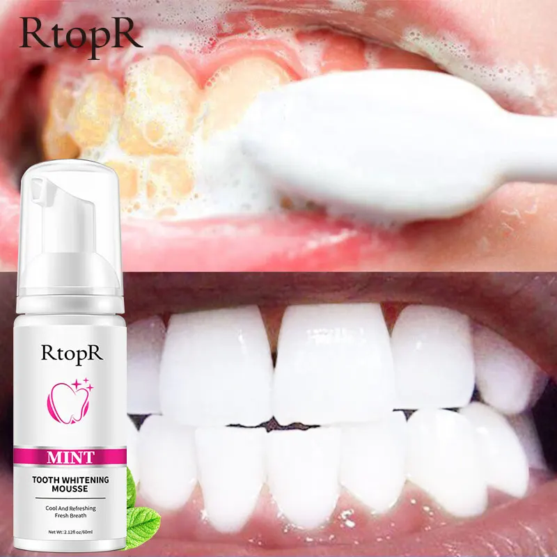 2PCS Mint Teeth Whitening Mousse Whitening Teeth Oral cleaning Oral Refreshing Repair Gums Healthy Plaque Stains Removal 