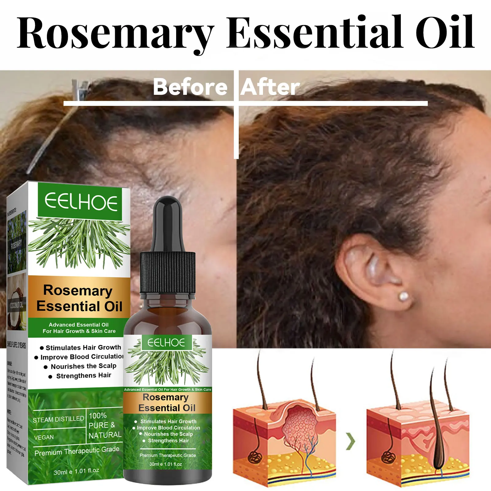 1-5 Bottles Rosemary Hair Growth Oil Fast Effective Repair Hereditary Postpartum Seborrheic Baldness Anti Hair Loss Serum 30ml