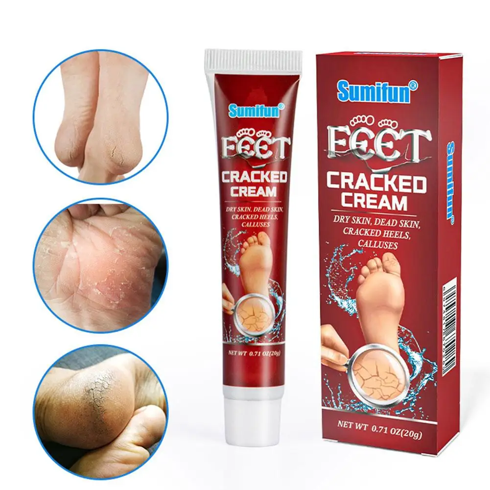 Creme rachado para mãos e pés e pés, rachaduras secas, anticongelante, creme protetor, hidratante, outono, inverno, E1l9