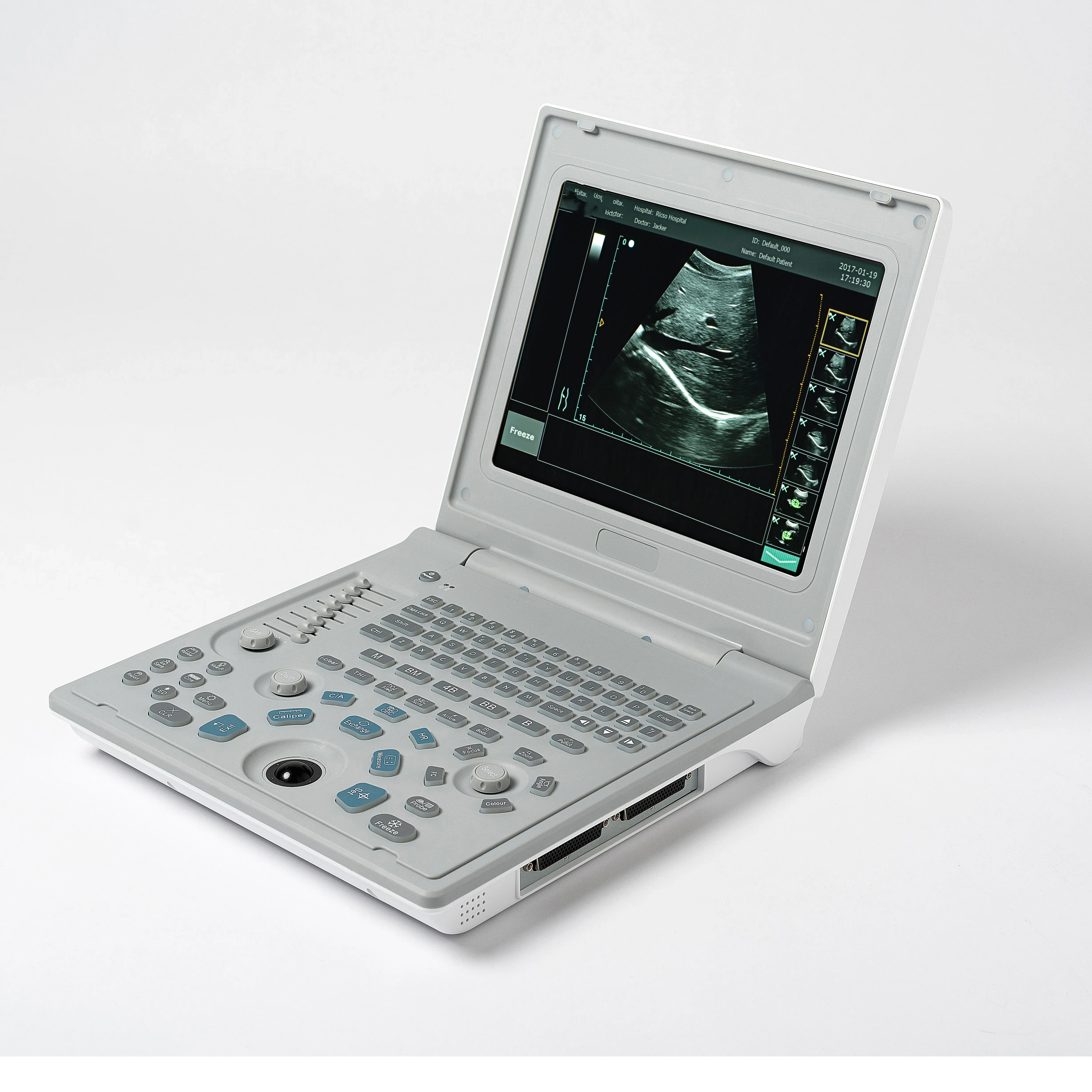 Mta1c Ultrasound Diagnostic Machine Handheld Colour Doppler Dog Ultrasound Scanner For Vet Hospital/clinic