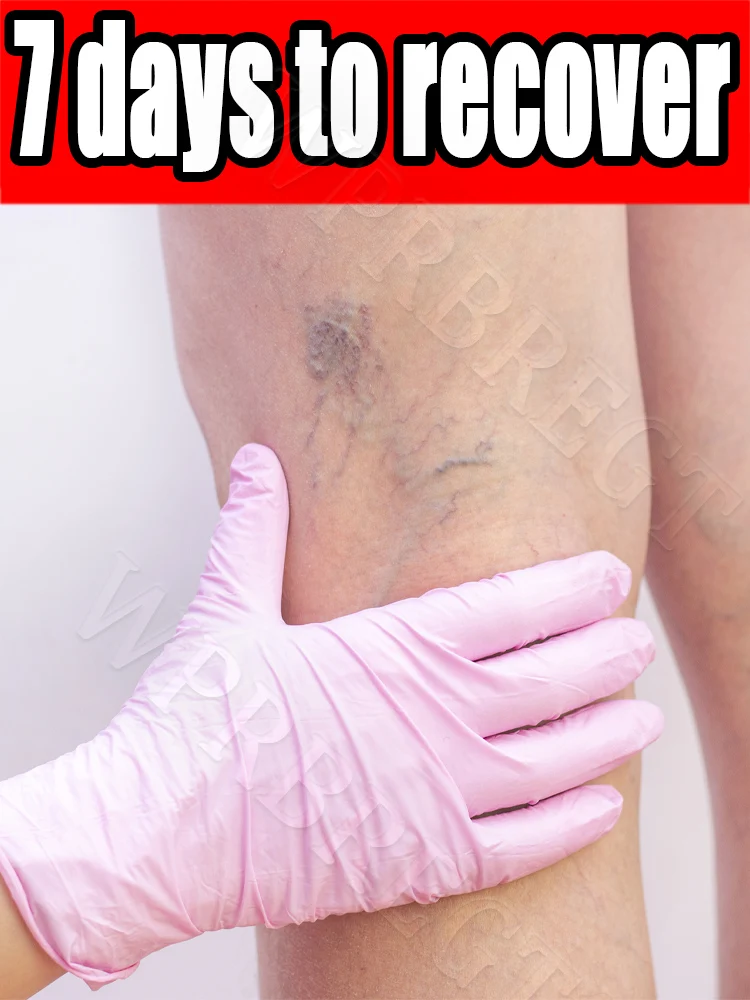 

Special cream for leg problems