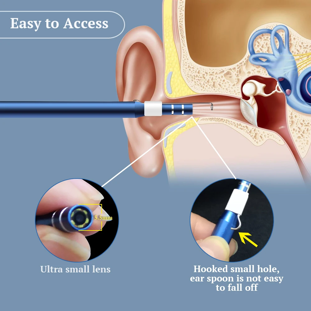 KERUI Ear Cleaning Endoscope Camera Ear Pick 3 in 1 USB OTG Visual Ear Spoon Functional Diagnostic Tool Ear Cleaner Android