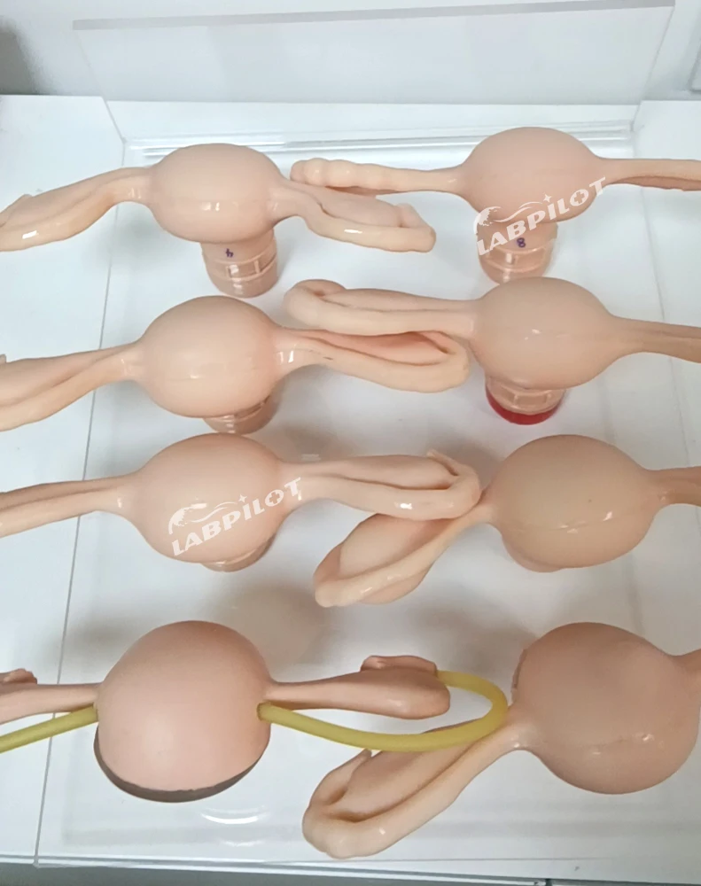 Uterus Simulator and Cervical Lesion Medical Demonstration Teaching Anatomy Model Gynecological Examination