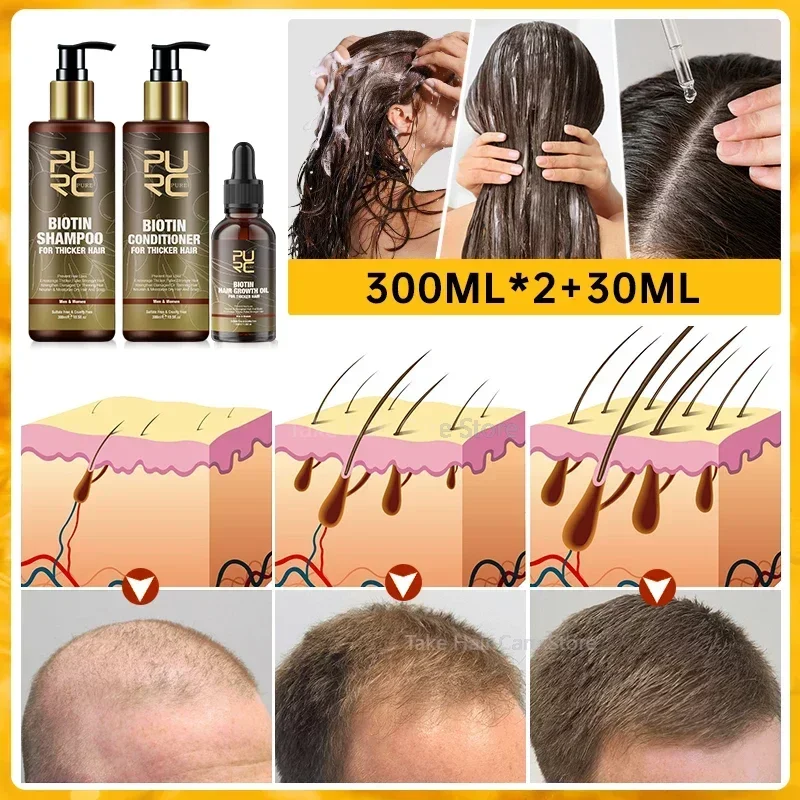 

Ginger Hair Growth Shampoo Set for Men Women Biotin Fast Regrowth Hair Loss Treatment Conditioner Hair Grow Products