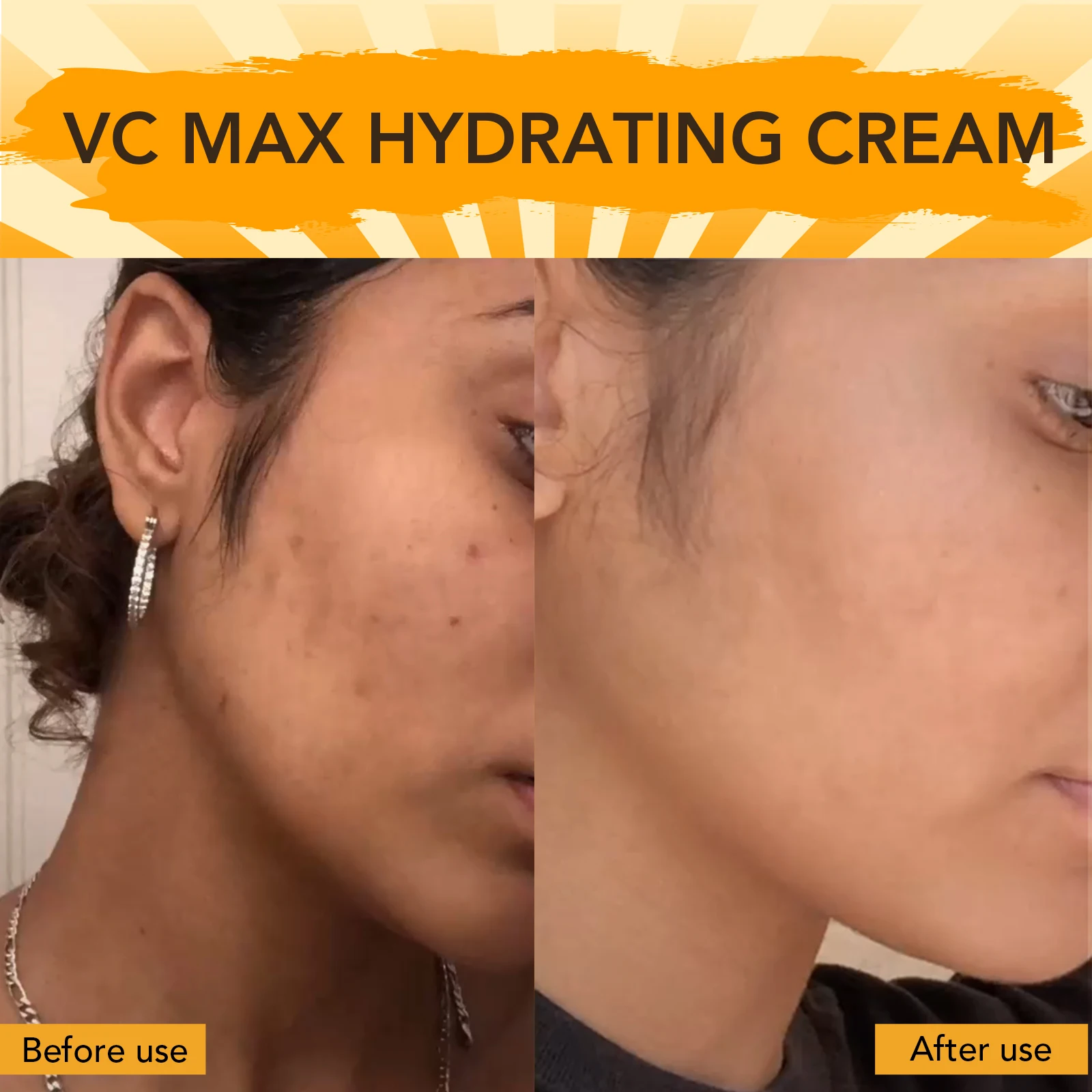 AILKE Vitamin C Brightening Face Cream, Hydration, Moisturizing, Anti-Wrinkles, with Collagen, Lightweight Texture, Non-Greasy