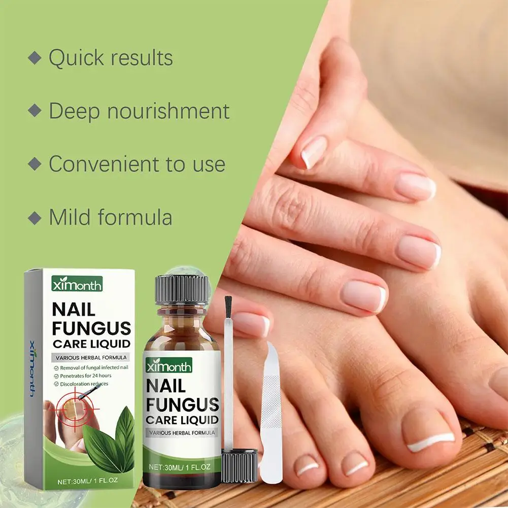 Onychomycosis Hand Foot Removal Repair Care 50g Nail Fungal Treatment Serum Anti Infection Toe Fungus Paronychia