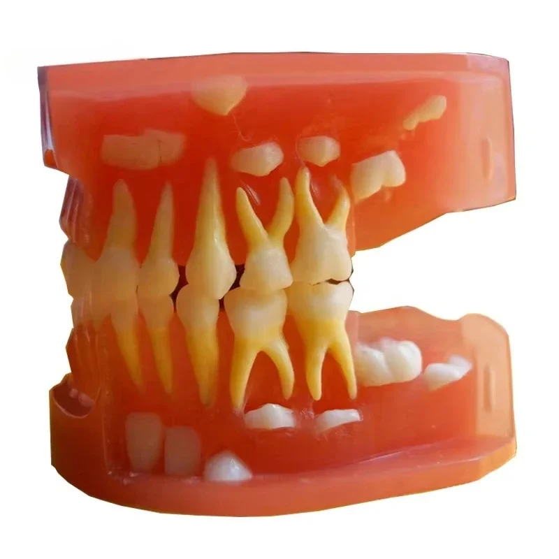 3-Year-old dentals model Human dentals model Medical science education model