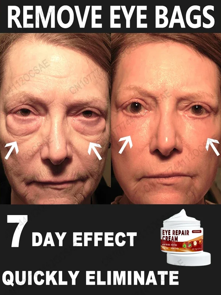 

Eye Cream Removes eye bags, eliminates eye puffiness and dark circles
