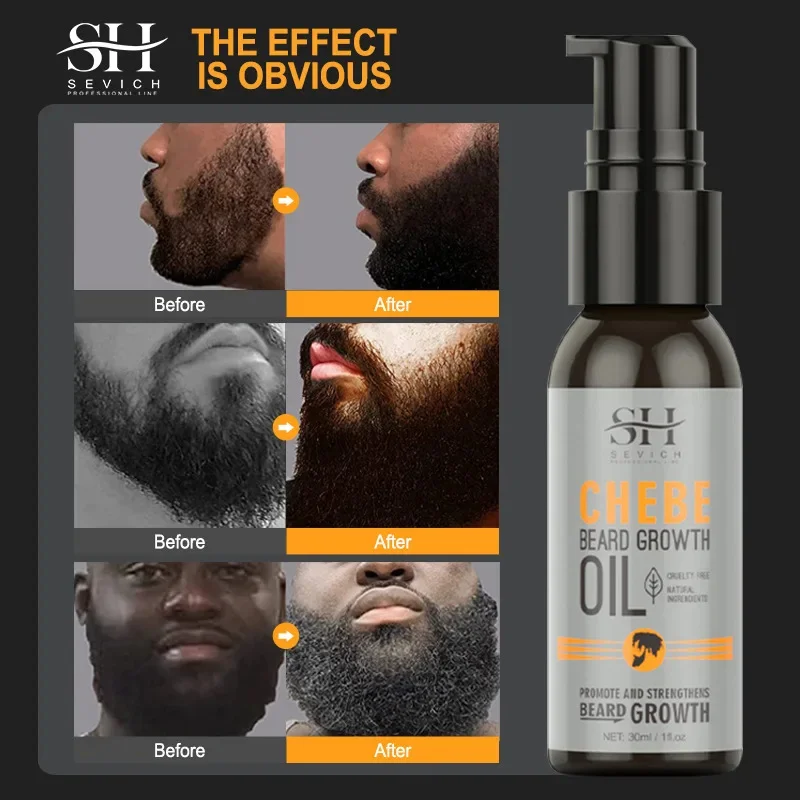 Huile essentielle de croissance de barbe injuste, spray de sérum nourrissant, traitement contre la perte de cheveux, gratitude pour la barbe