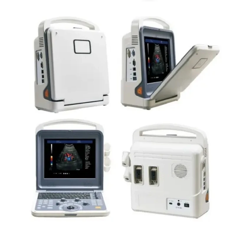 4D Full Digital Color Doppler Ultrasound Diagnostic System Competitive Price 6 Languages Portable Ultrasound