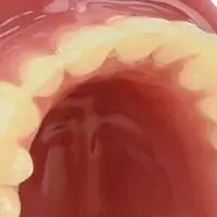 

Новая стоматологическая модель из смолы, нормальная стоматология для взрослых, медицинская стоматологическая практика, обучение, инструменты для обучения зубов