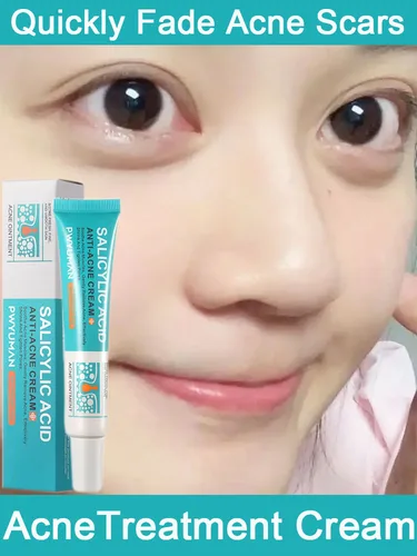 Crema para el tratamiento del acné, ácido salicílico, reparación de manchas de espinillas, limpieza profunda, contracción de poros, Control de aceite antiacné, hidratante, cuidado de la piel