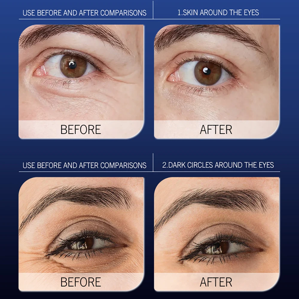 Snake Venom Peptide Moisturizing Eye Cream Eye care Eye contour Reduce Eye bags dark circles removal Eye Care Serum skincare