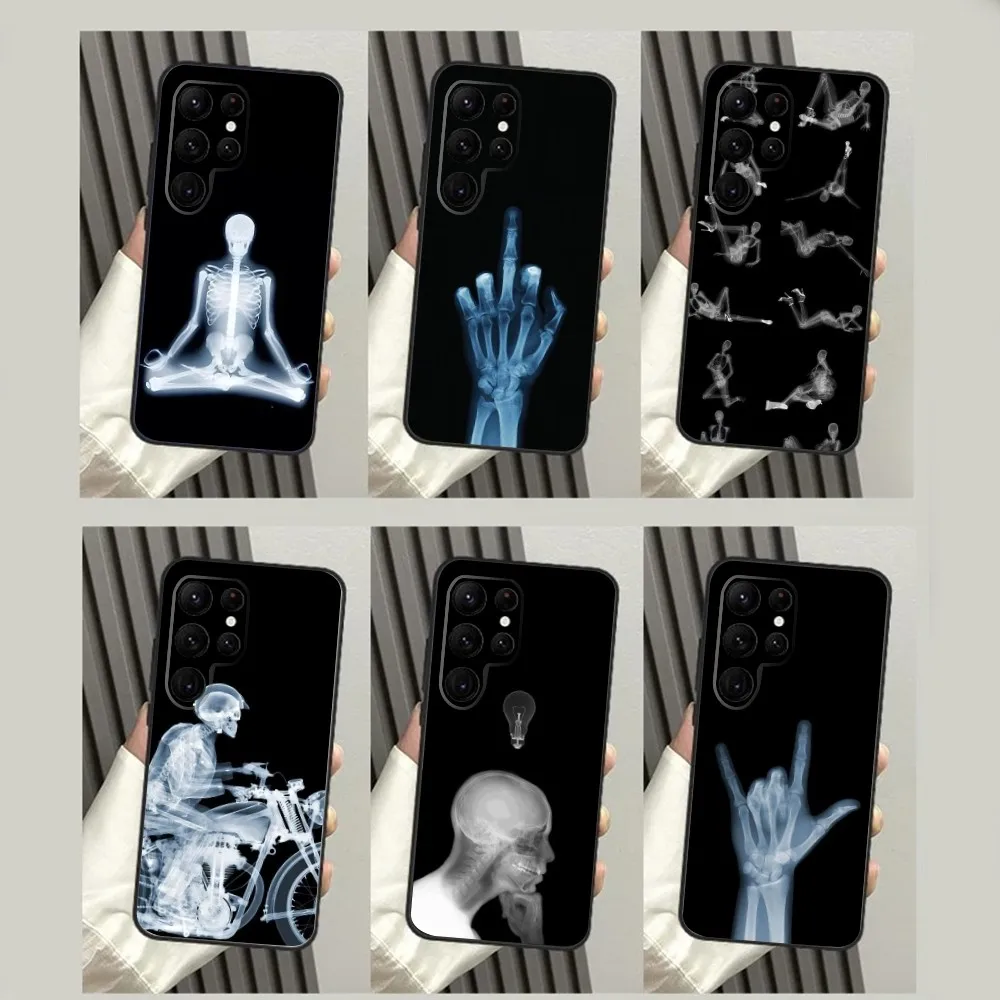 

X-RAY Radiological Skeleton Phone Case For SamsungS24,S23,S22,S21,S20 Ultra Pro S10,S30Plus,S9,20lite Ultra Black Cover