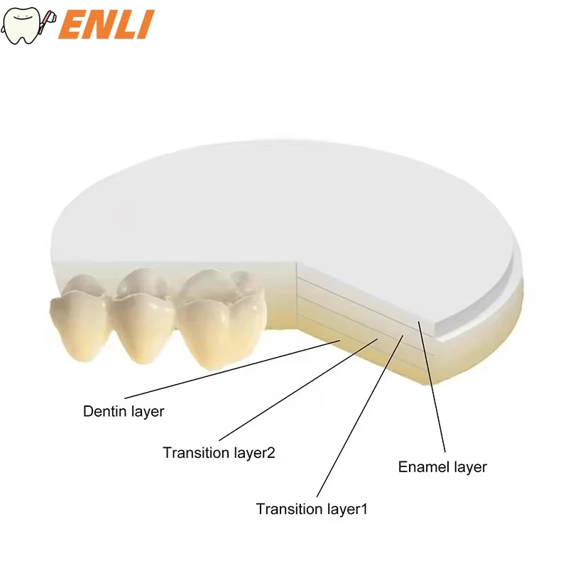 ONICE Blocos de zircônio de zircônia dentária CAD/CAM Cerâmica de zircônia dentária 1200Mpa 3D-Pro ML Zircônia 98mm Estética 1 caixa