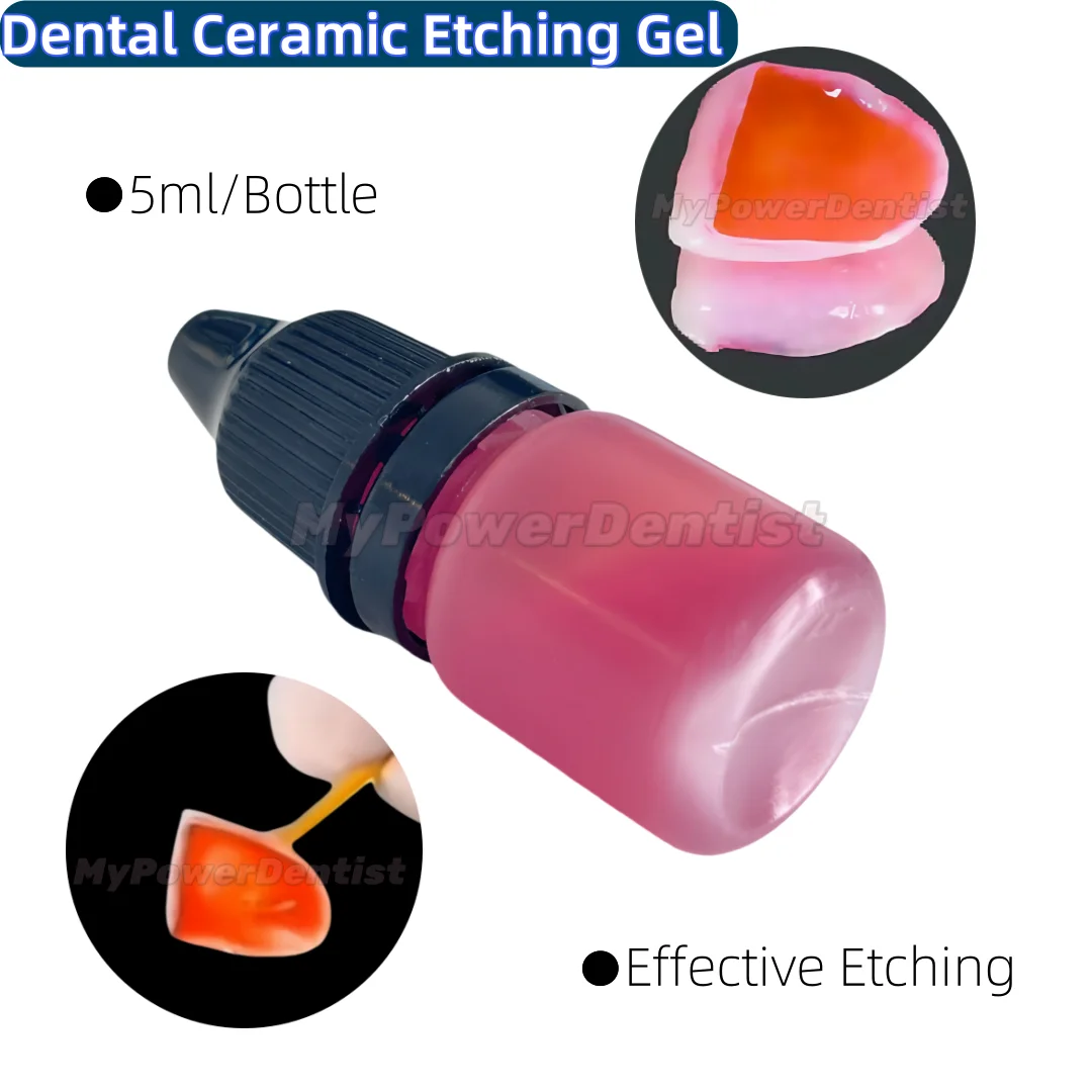 

Ceramic Dental Etching Gel Enhances Hydrofluoric Acid Effectively Etches 5ml/Bottle