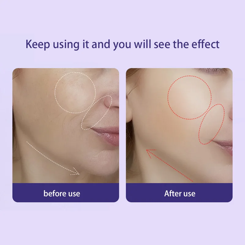 Face Machine Neck Lifting Beauty Device Anti Wrinkle Facial Care Massager Skin Rejuvenation Double Chin Vibrator Dropshipping