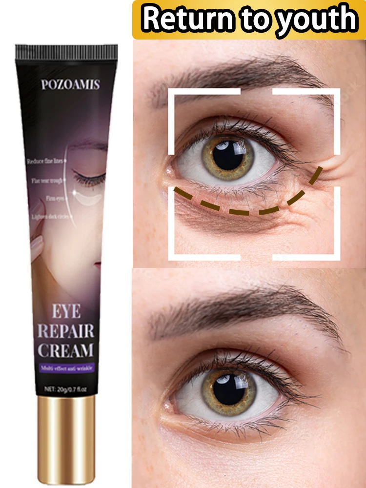 

Focus on removing eye bags and dark circles, this 30-year-old store will restore your beautiful appearance