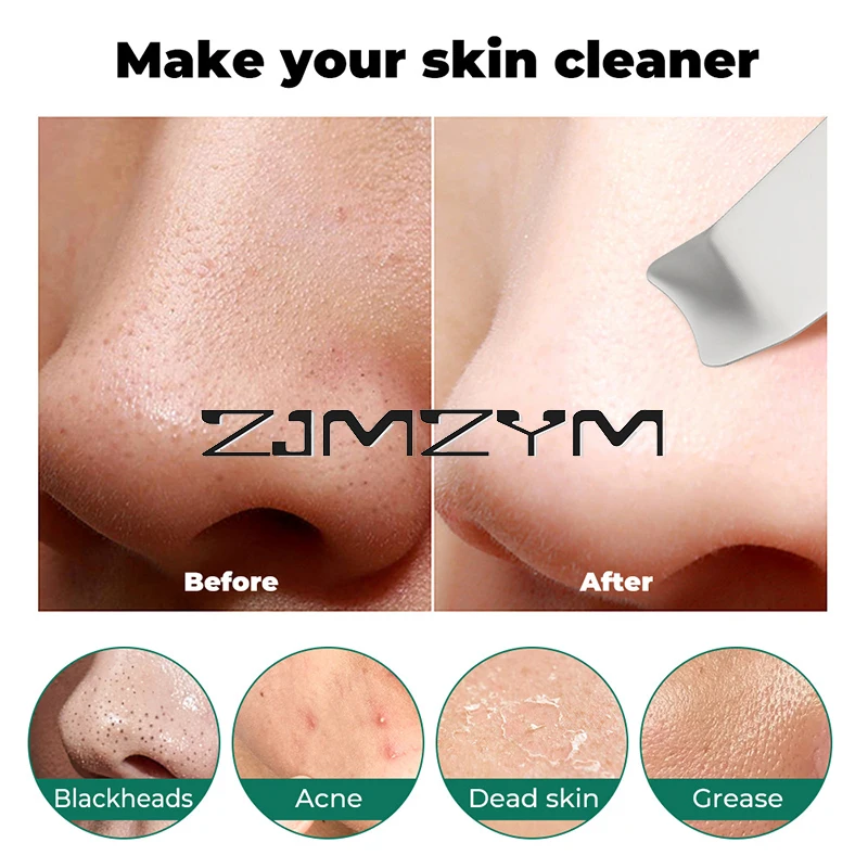 Ultrasonic Electric Skin Scrubber, Limpador Facial, Poros Limpeza, Cravo Absorvendo, Levantamento Do Dispositivo