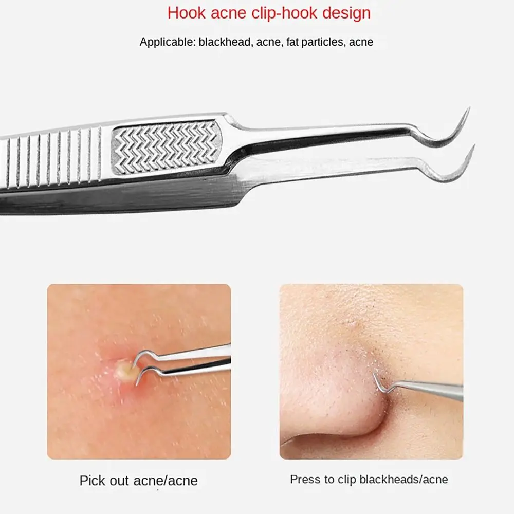Effectieve roestvrijstalen celclip Diepe reiniger Tweekoppige acne-naald Huidgereedschap Mee-eterpincet Dames Heren
