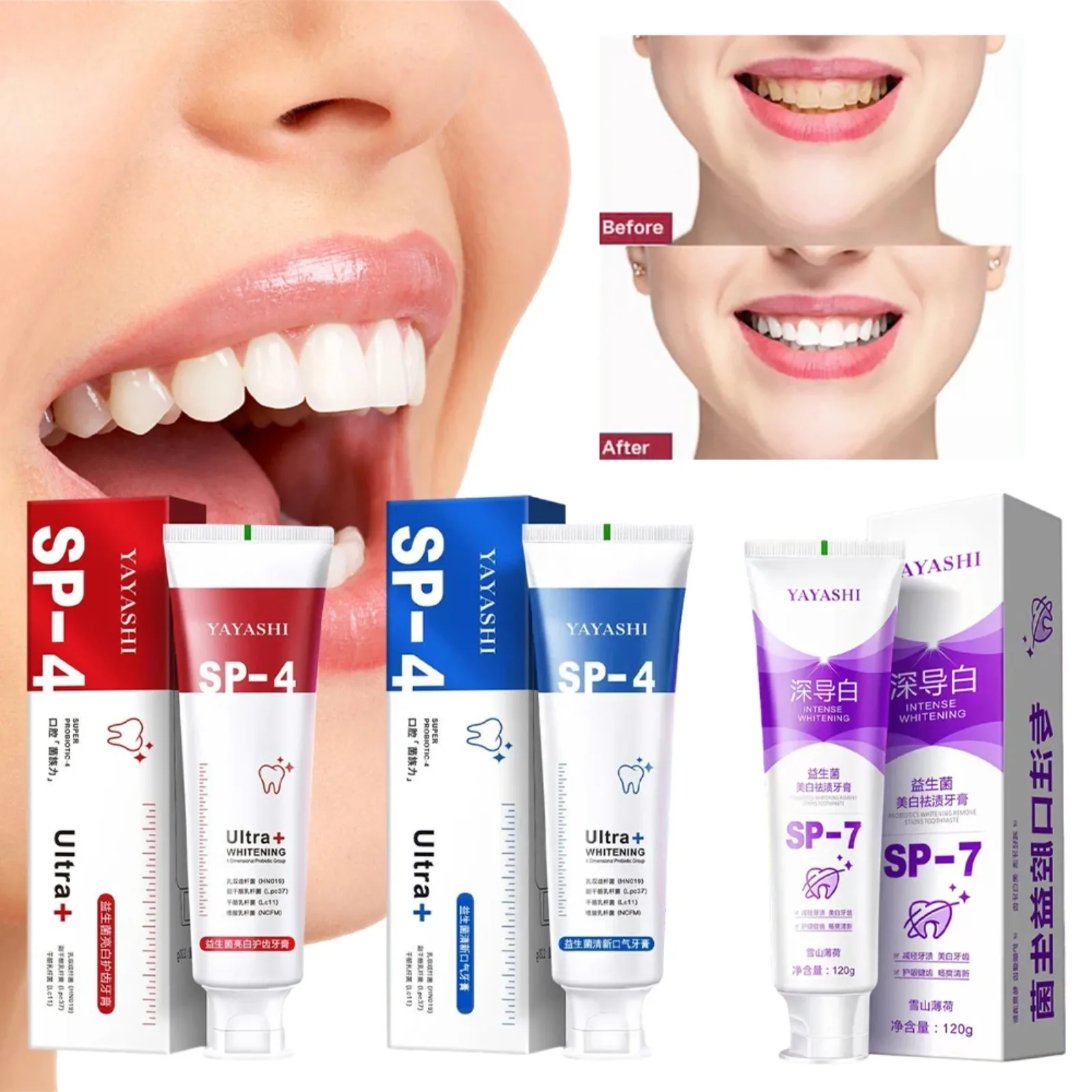 

Probiotic Toothpaste SP-4 Brightening Whitening Toothpaste Protect Gums Fresh Breath Mouth Teeth Cleaning Health Oral Care