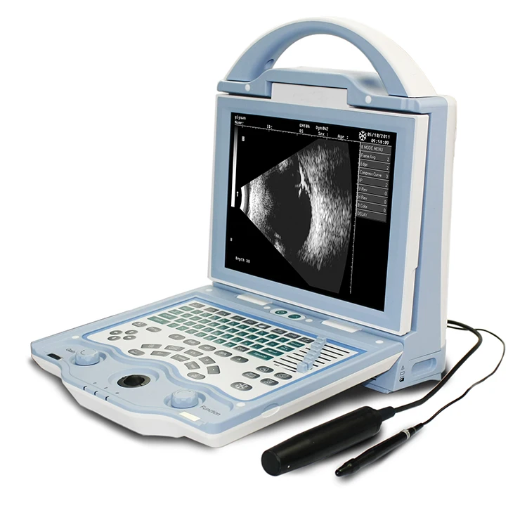 Ophthalmology AB Scan ODU-5 Portable Ophthalmic Ultrasound Scanner Price