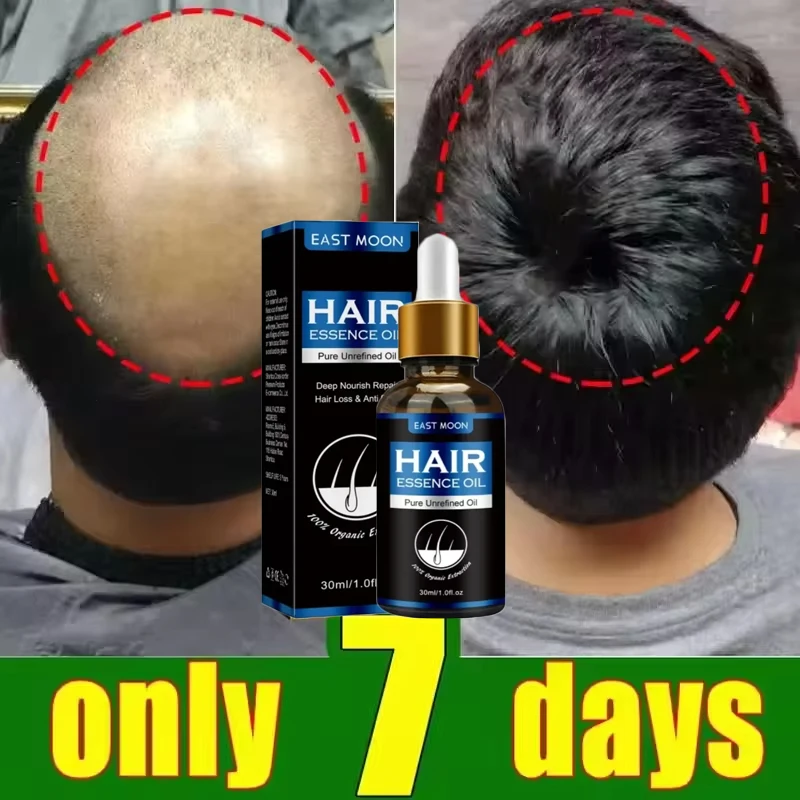 Hair Growth Oil Effective Rapid Repair Fast Baldness Hair Postpartum Hair Loss Follicles Hereditary Hair Loss Hair Care Solution