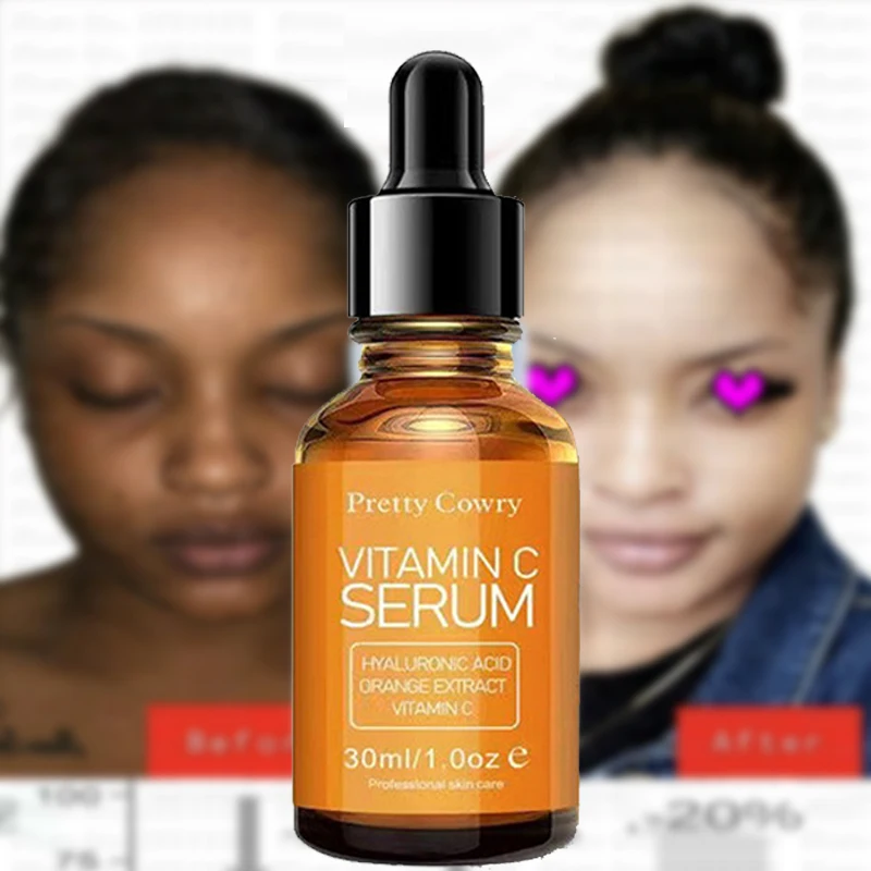 30g Vitamin E vitamin C nicotinamide collagen retinol hyaluronic acid essence anti-wrinkle moisturizing facial liquid face serum