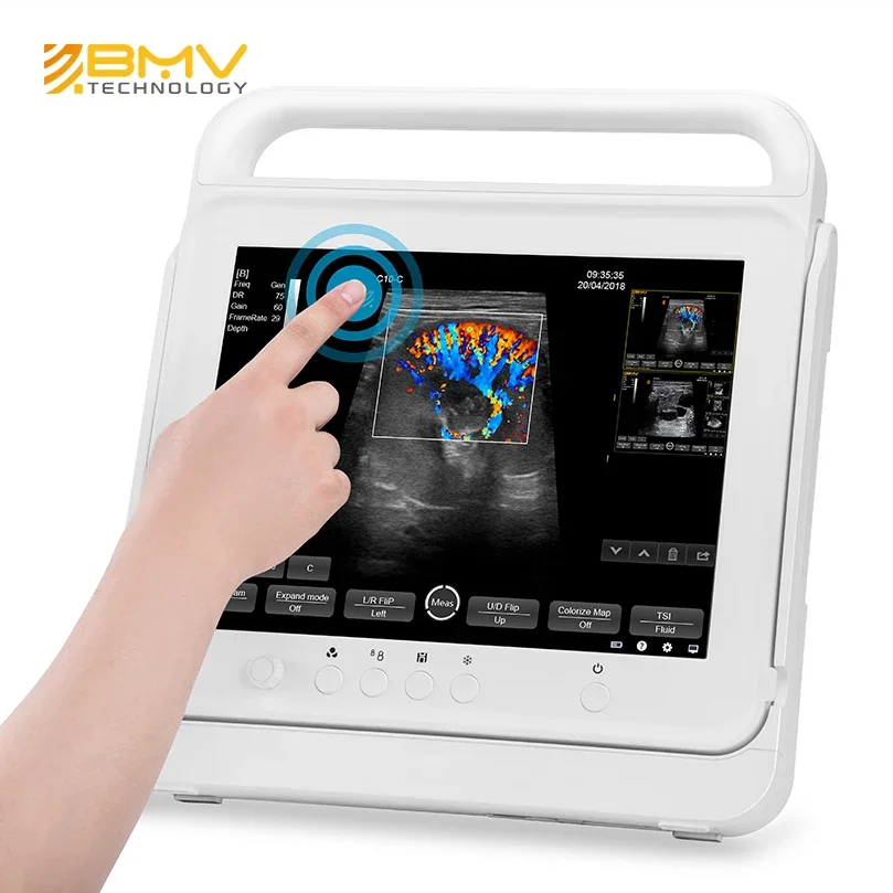 pet bovine equine human use touchscreen echosonogram support rectal and microconvex probe