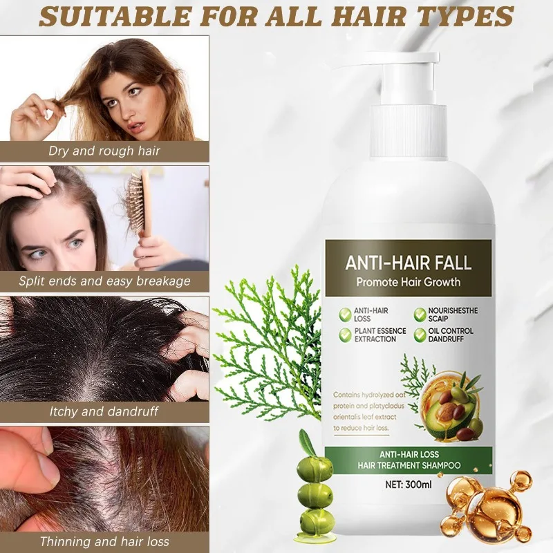 Shampoo gegen Haarausfall, reich an verschiedenen Pflanzenextrakten zur Förderung des Haarwachstums, voluminös, feuchtigkeitsspendend, alle Haartypen