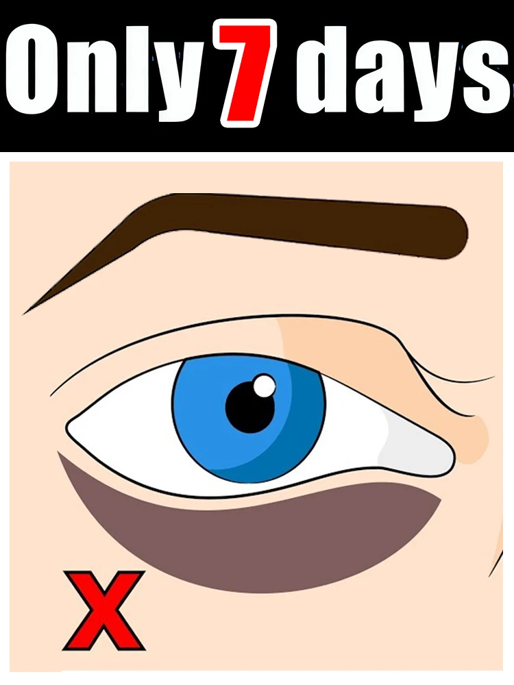 

Праздничные акции, ГОРЯЧИЕ примеры, помогающие людям, которые вокруг глаз решают их проблемы, горячая распродажа