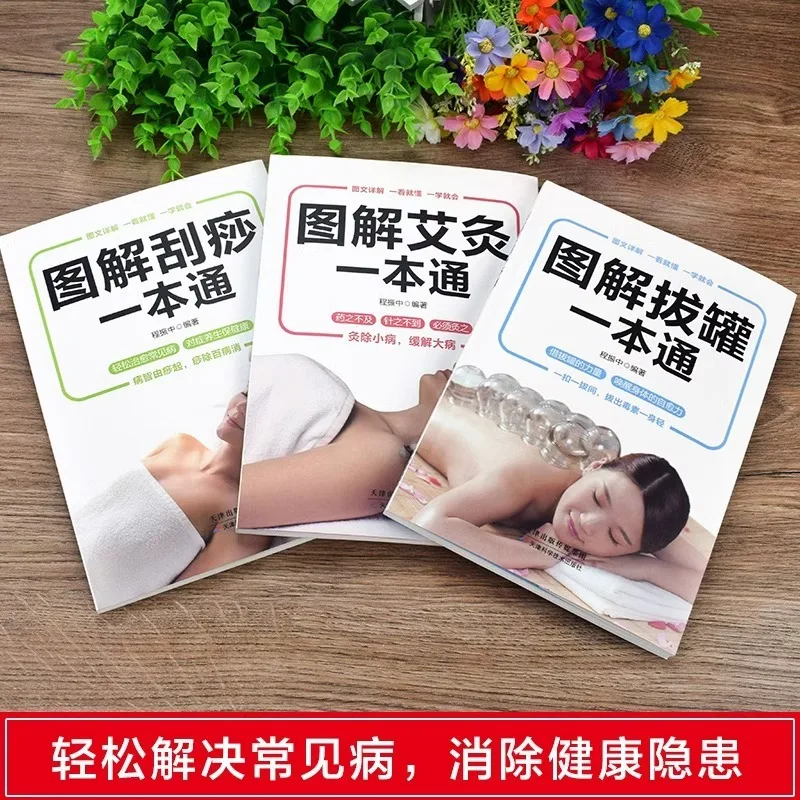 Moxibustion, Cupping, Scraping, and Sha, A Book on Illustrated Techniques for Home Use of Human Meridians and Acupoints