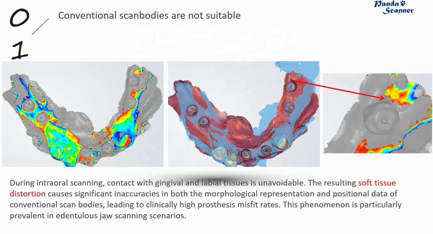 High Accuracy Electricity-Powered Scanbody Kit for All  Scanners | Edentulous Case Dental Lab