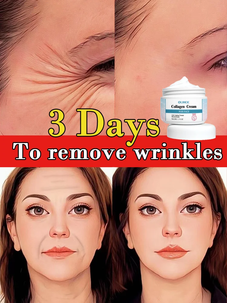 Wrinkle reduce cream face remove  nasolabial folds expression lines