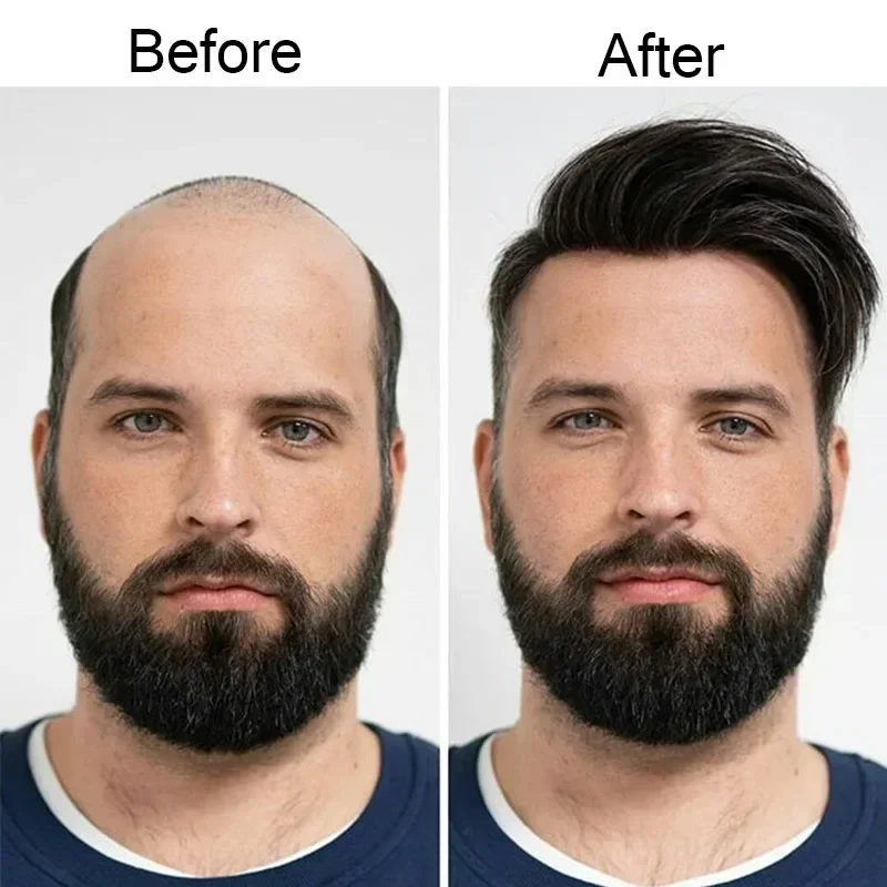 Natural Hairline Male Wig Invisible Knot Replacement Systems Spell Toupee - Durable Comfortable Men's Hairpiece for All-Day Wear