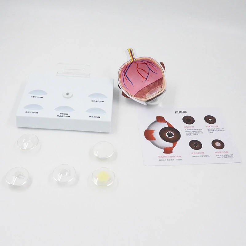 Pathological eye model Cataract eye teaching props Ophthalmic model