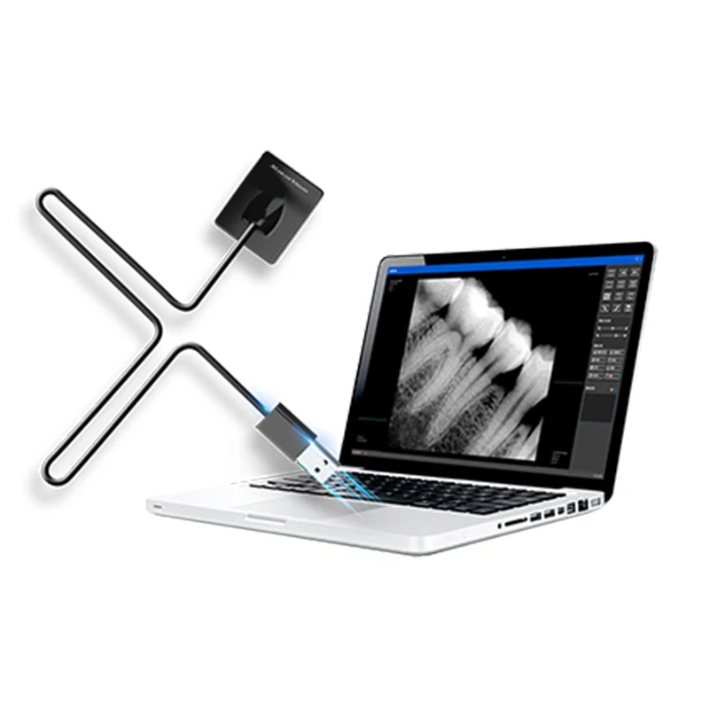 Factory Price Medical Digital Dental X Ray Intraoral Clinic X-ray Sensor