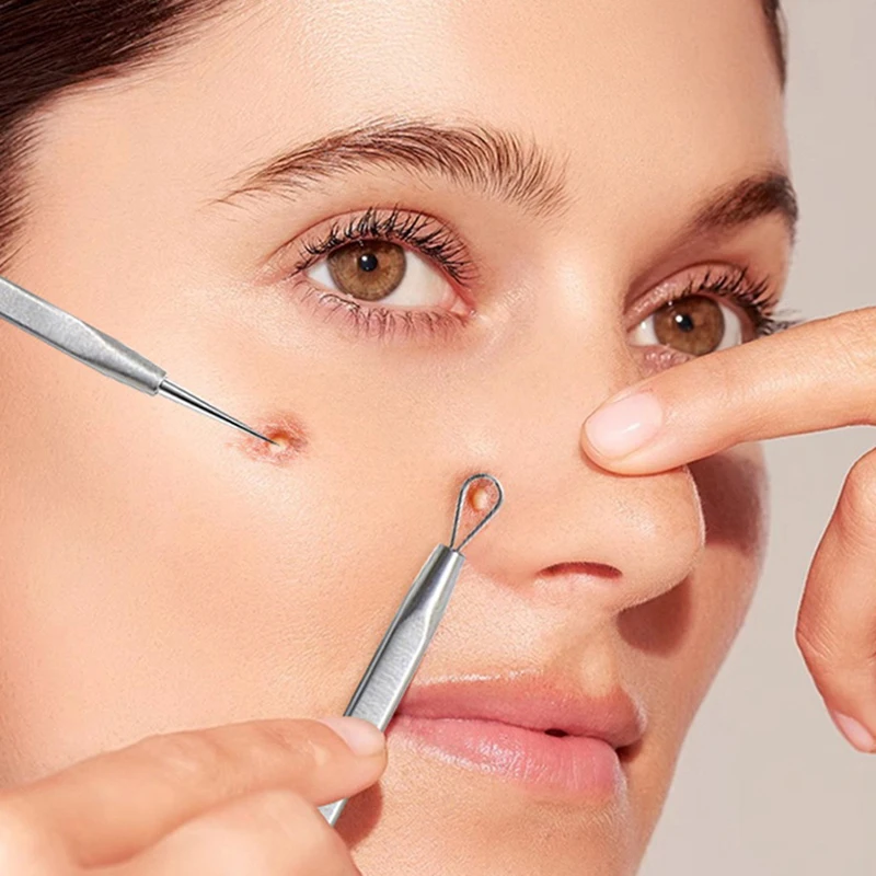 Rvs Mee-eter schop Dubbele Hoofd Remover Tool Puistje Acne Talg Verwijderen Gezicht Smet Extractor Gereedschap Gezicht Huidverzorging