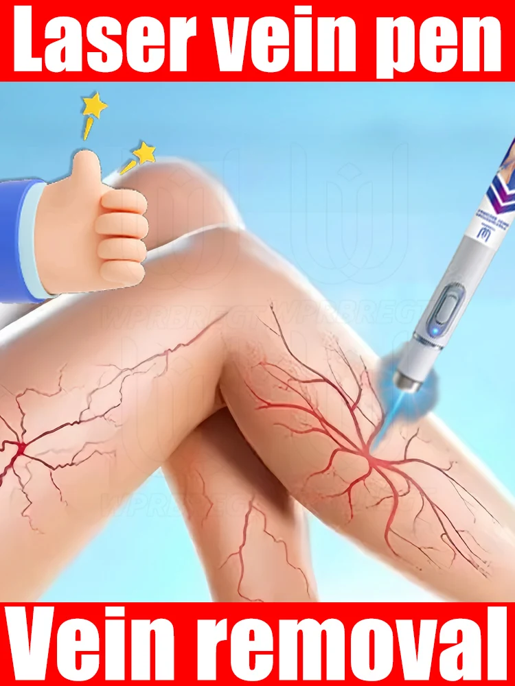 

Safe laser repair of varicose veins