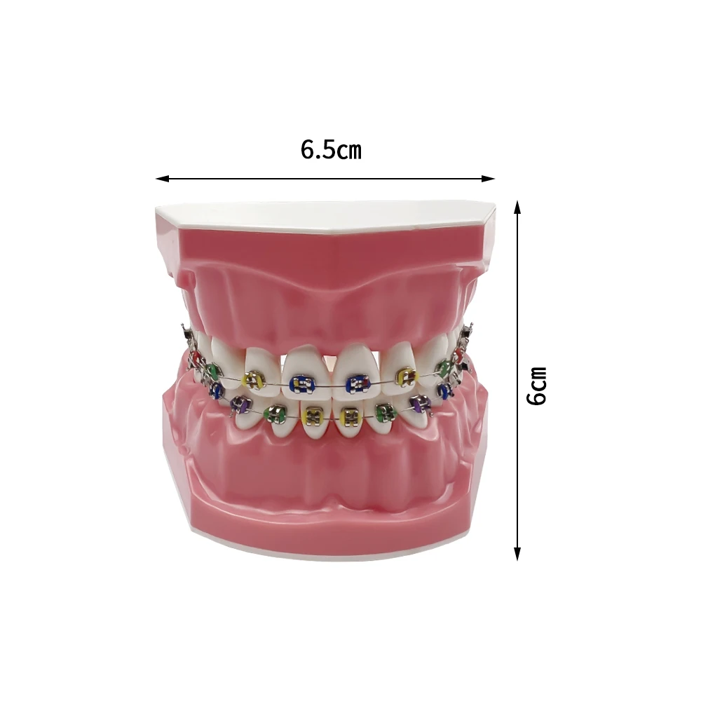 Dental Orthodontic Model With All Metal Bracket Ortho Teeth Model For Teaching Studying Dentist-Patient Education Demonstration